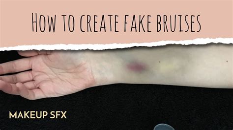 injuries that are easy to fake